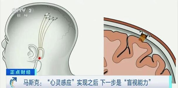 第一位运用大年夜脑芯片控制电脑和下棋的神经链接患者在直播中亮相_阿布_装备 智能 第一位运用大年夜脑芯片控制电脑和下棋的神经链接患者在直播中亮相_阿布_装备 第一位运用大年夜脑芯片控制电脑和下棋的神经链接患者在直播中亮相_阿布_装备 智能