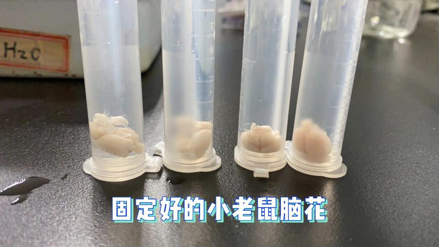 大年夜脑深处的芯片：不必摘除自动消融_硅片_小鼠 大年夜脑深处的芯片：不必摘除自动消融_硅片_小鼠 智能