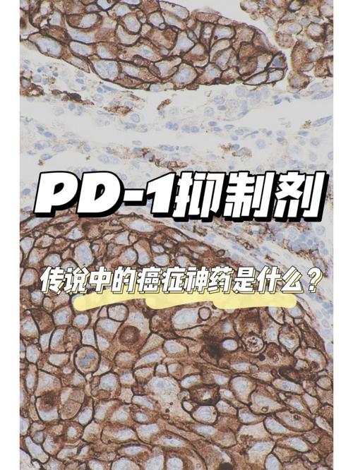国内1类化药的「命运齿轮」开始迁徙改变_克制剂_药物 国内1类化药的「命运齿轮」开始迁徙改变_克制剂_药物 互联网