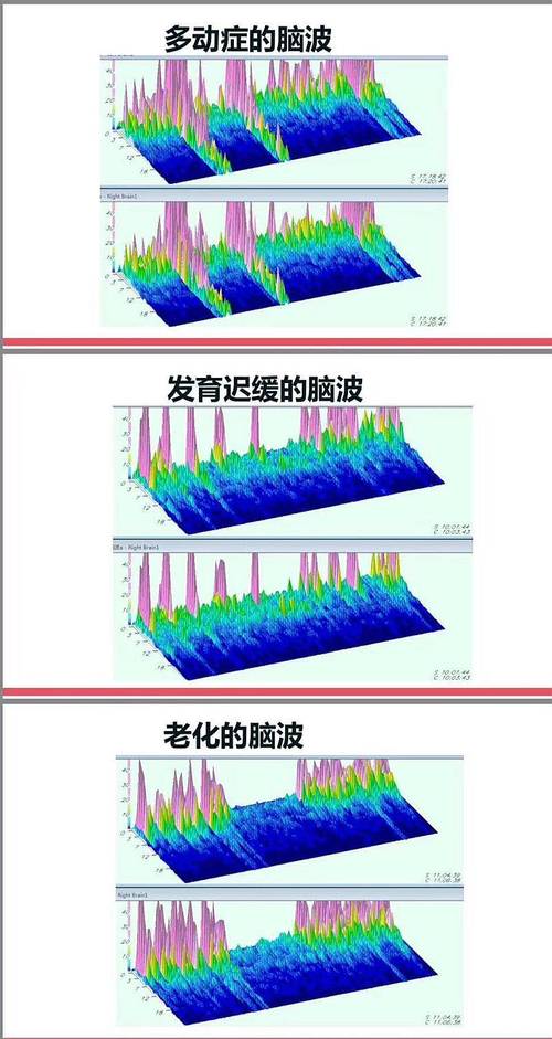 微软推出深度进修加速平台脑波计划：FPGA驱动实时人工智能_脑波_模子 微软推出深度进修加速平台脑波计划：FPGA驱动实时人工智能_脑波_模子 智能