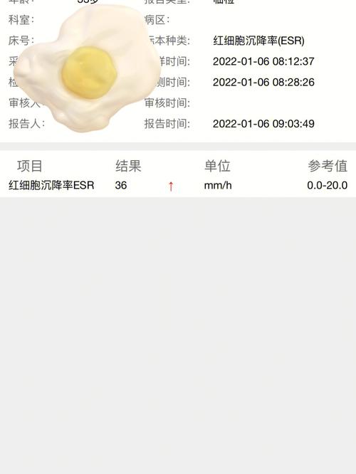 若何看懂风湿科化验单(二)?解读aPLs、抗dsDNA抗体、血沉和ACPA_抗体_血沉 智能 若何看懂风湿科化验单(二)?解读aPLs、抗dsDNA抗体、血沉和ACPA_抗体_血沉 若何看懂风湿科化验单(二)?解读aPLs、抗dsDNA抗体、血沉和ACPA_抗体_血沉 智能